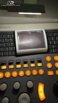 Ultrasound device for medical clinics Medison Sansung